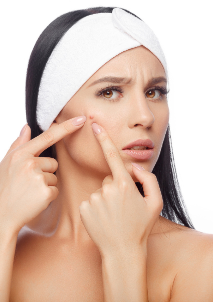 acne behandeling